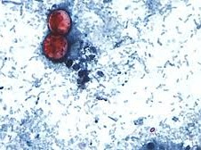 Image: Diarrhea Outbreak in Michigan Linked to Lettuce and Salad Greens
