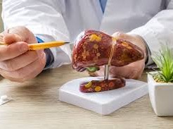 Image: Rising Fatty Liver Disease Among Non-Drinkers: Causes and Solutions