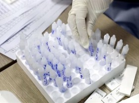 Image: 30 new domestic Covid-19 infections detected in four localities