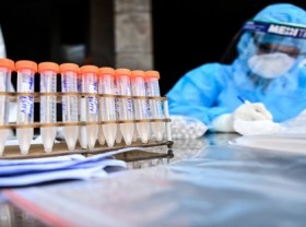 Image: Hanoi highly vulnerable to new Covid 19 outbreak
