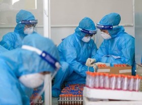 Image: 88 new Covid-19 cases confirmed