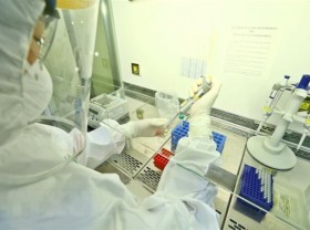 Image: New Covid-19 infections soar by 102