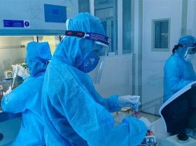Image: New Covid-19 infections soar by 94