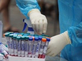 Image: Vietnam logs 135 new COVID-19 infections on June 21 afternoon