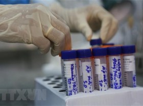 Image: Vietnam reports 127 new Covid-19 cases