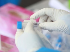 Image: Vietnam’s Covid-19 infections surge by 240