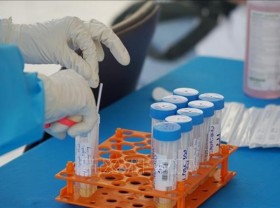 Image: Single-day rise in Covid-19 cases hits new record