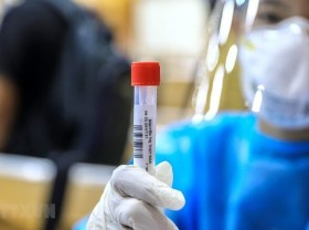 Image: Vietnam detects 277 fresh Covid-19 cases, mostly in HCMC