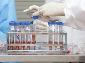 Image: Vietnam logs additional 12,103 COVID-19 cases