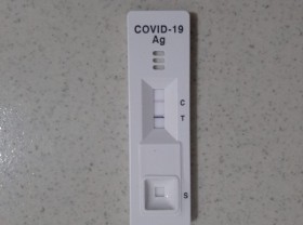 Image: Covid-19 re-infection, insider experience