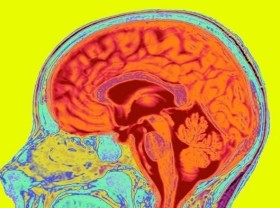 Image: COVID-19 can cause brain shrinkage, memory loss - study