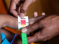 Image: UNICEF Reports Deepening Child Hunger Crisis in Somalia
