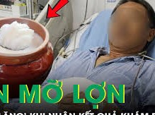 Image: 75-Year-Old Man Shocked by Health Results After Daily Fat Consumption