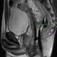 Image: Rare Medical Case: Patient Treated for Unprecedented Injury