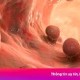 Image: Colorectal Cancer Rates Surge in Ho Chi Minh City
