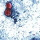Image: Diarrhea Outbreak in Michigan Linked to Lettuce and Salad Greens
