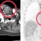 Image: Man Diagnosed with Two Types of Cancer Due to Long-Term Habits