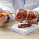 Image: Rising Fatty Liver Disease Among Non-Drinkers: Causes and Solutions