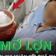 Image: 75-Year-Old Man Shocked by Health Results After Daily Fat Consumption