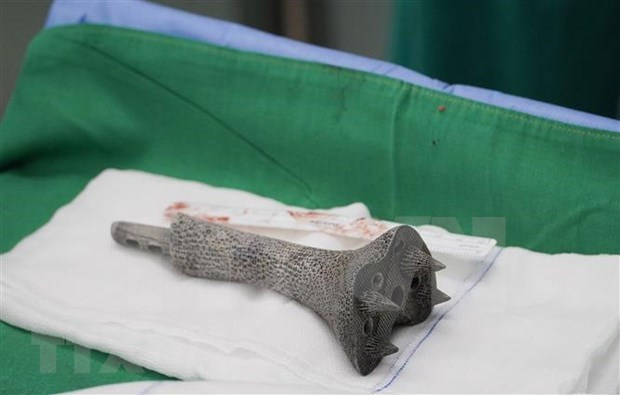 Cho Ray Hospital successfully applies new technique in bone surgery