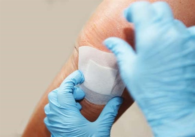 Made-in-Vietnam app set to revolutionize wound diagnosis