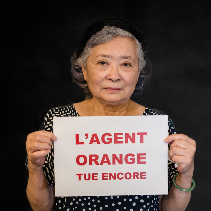 Musician defies challenges caused by Agent Orange