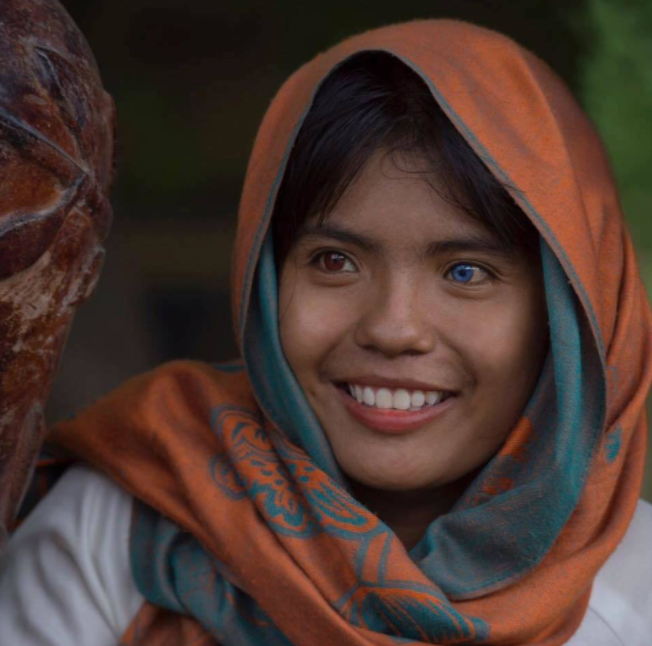 Vietnamese Girl with Different Colored Eyes Stuns the World