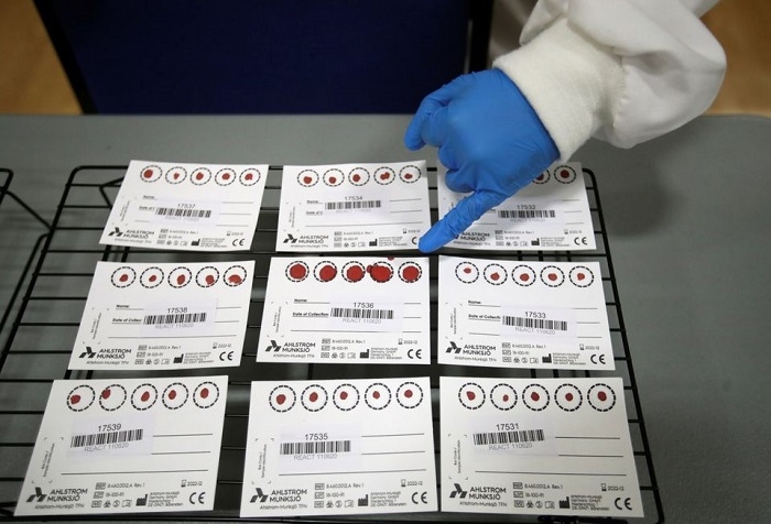 UK to begin offering COVID antibody testing to general public for first time -media