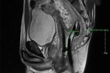Rare Medical Case: Patient Treated for Unprecedented Injury