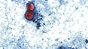 Diarrhea Outbreak in Michigan Linked to Lettuce and Salad Greens