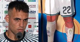 The Superstitions of Argentina's National Team: Lisandro Martínez and Rituals