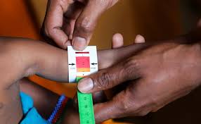 UNICEF Reports Deepening Child Hunger Crisis in Somalia